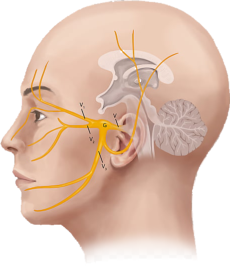 trigeminal nerve trigeminal neuralgia headache ear